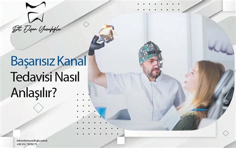 Başarısız Kanal Tedavisi Nasıl Anlaşılır? İşaretler ve Çözümler