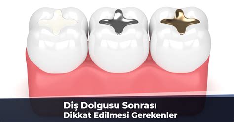 Diş Dolgusu Sonrası Dikkat Edilmesi Gerekenler: Öneriler ve İpuçları