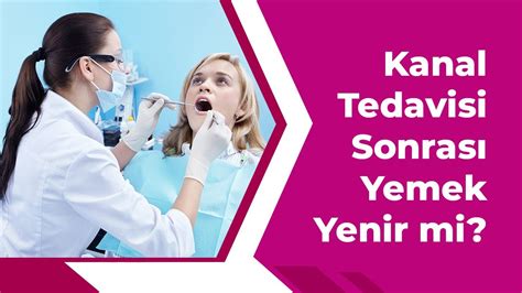 Kanal Tedavisi Sonrası Yemek Yeme: Ne Zaman ve Nasıl?