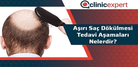 Tedavi Aşamaları Nelerdir?