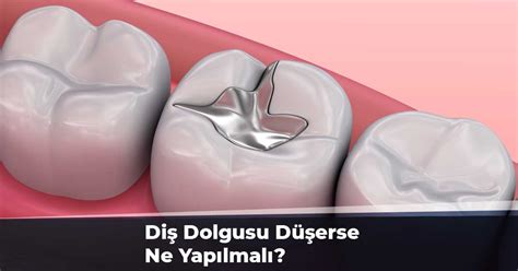 Diş dolgusu ağrısı ve endişesi