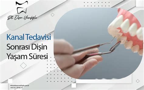 Kanal Tedavisi İle İlgili Sık Sorulan Sorular: Hastalarından Gelen Cevapsız Sorular